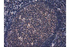 Image no. 7 for anti-Acyl-CoA Thioesterase 12 (ACOT12) antibody (ABIN1496415)