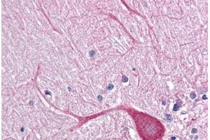 Human Brain, Cerebellum: Formalin-Fixed, Paraffin-Embedded (FFPE) (TLR3 Antikörper  (AA 514-657))