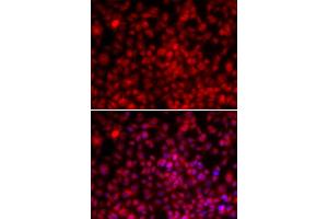 Immunofluorescence (IF) image for anti-Interleukin Enhancer Binding Factor 2, 45kDa (ILF2) antibody (ABIN1980249) (ILF2 Antikörper)