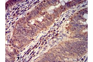 Immunohistochemistry (IHC) image for anti-Folate Receptor 1 (Adult) (FOLR1) (AA 41-227) antibody (ABIN5611335)