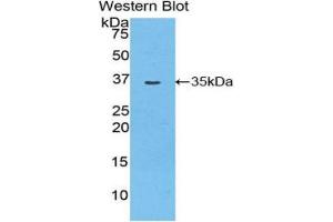 Western Blotting (WB) image for anti-Myosin ID (MYO1D) (AA 512-788) antibody (ABIN1859951)