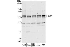 Western Blotting (WB) image for anti-Cyclin G Associated Kinase (GAK) (AA 675-725) antibody (ABIN7453089) (GAK Antikörper  (AA 675-725))