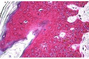 Human Skin: Formalin-Fixed, Paraffin-Embedded (FFPE) (FGFR2 Antikörper  (AA 621-724))