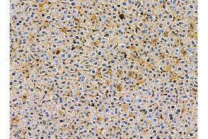 ABIN7095387 and ABIN7099444 at 1/100 staining mouse liver tissue by IHC-P. (Lunapark Antikörper)