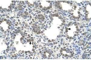 Human Lung (SLC26A5 Antikörper  (Middle Region))