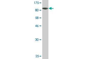 Western Blotting (WB) image for anti-Core-binding Factor, Runt Domain, alpha Subunit 2, Translocated To, 2 (CBFA2T2) (AA 1-614) antibody (ABIN522604)