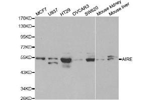 Western blot analysis of extracts of various cell lines, using AIRE antibody. (AIRE Antikörper)