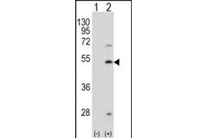 Western blot analysis of FDFT1 (arrow) using rabbit polyclonal FDFT1 Antibody  (ABIN389052 and ABIN2839261). (FDFT1 Antikörper  (AA 140-170))