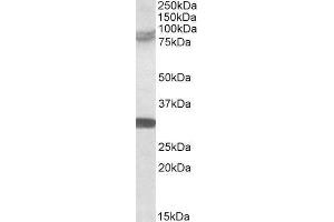 Western Blotting (WB) image for Tripartite Motif Containing 2 (TRIM2) peptide (ABIN370095)