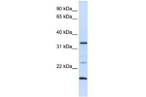Western Blot showing ARGFX antibody used at a concentration of 1-2 ug/ml to detect its target protein. (ARGFX Antikörper  (N-Term))