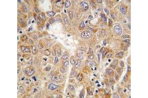 Immunohistochemistry (IHC) image for anti-Phosphoglycerate Kinase 1 (PGK1) (AA 117-145) antibody (ABIN3032224)