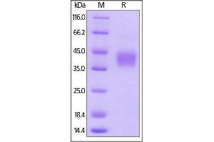 SDS-PAGE (SDS) image for Fc Fragment of IgG, Low Affinity IIIb, Receptor (CD16b) (FCGR3B) (AA 17-208) (Active) protein (His tag) (ABIN6253653)