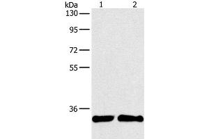 Western Blot analysis of A431 and 231 cell using ARTN Polyclonal Antibody at dilution of 1:350 (ARTN Antikörper)