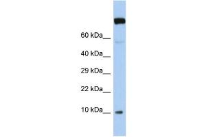 Host:  Rabbit  Target Name:  WBP5  Sample Type:  Jurkat Whole Cell lysates  Antibody Dilution:  1. (WW Domain Binding Protein 5 (WBP5) (N-Term) Antikörper)
