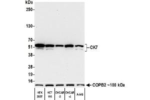 Western Blotting (WB) image for anti-Keratin 7 (KRT7) (C-Term) antibody (ABIN7453965)