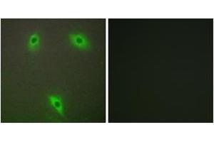 Immunofluorescence analysis of A549 cells, using KLHL3 Antibody.