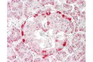 Human Pancreas: Formalin-Fixed, Paraffin-Embedded (FFPE). (RPL14 Antikörper  (Biotin))