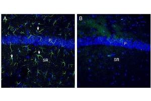 Expression of Otopetrin-1 in mouse hippocampus.