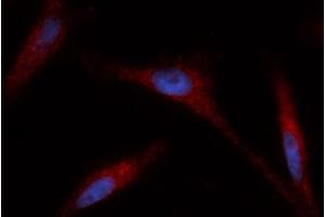 Immunofluorescence (IF) image for anti-Glutaredoxin 1 (GRX1) (AA 1-106) antibody (PE) (ABIN5565554)