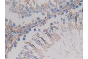 Detection of GSTA4 in Rat Testis Tissue using Polyclonal Antibody to Glutathione S Transferase A4 (GSTA4) (GSTA4 Antikörper  (AA 2-222))