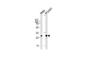 Lane 1: HeLa Cell lysates, Lane 2: mouse brain lysates, probed with CDK5 (1321CT281. (CDK5 Antikörper)