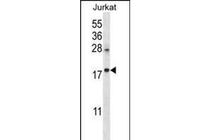 KRT1 Antibody (C-term) (ABIN656288 and ABIN2845597) western blot analysis in Jurkat cell line lysates (35 μg/lane). (KRTAP25-1 Antikörper  (C-Term))