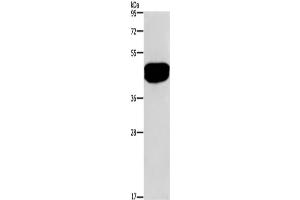 Western Blotting (WB) image for anti-serologically Defined Colon Cancer Antigen 3 (SDCCAG3) antibody (ABIN2421479) (SDCCAG3 Antikörper)