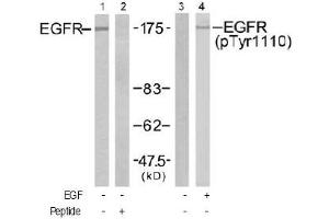 Image no. 2 for anti-Epidermal Growth Factor Receptor (EGFR) (Tyr1110) antibody (ABIN197517) (EGFR Antikörper  (Tyr1110))