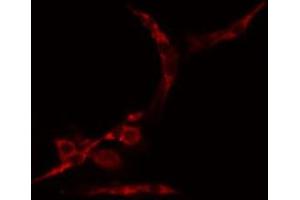 ABIN6274991 staining Hela cells by IF/ICC. (CEP70 Antikörper  (Internal Region))