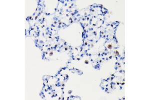 Immunohistochemistry of paraffin-embedded rat lung using [KO Validated] Cyclin D1 Rabbit mAb (ABIN7266561) at dilution of 1:100 (40x lens).