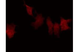 ABIN6269367 staining HeLa by IF/ICC. (NFKBIB Antikörper  (N-Term))