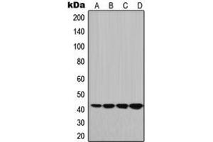 Western blot analysis of HLA-G expression in JEG3 (A), HeLa (B), Raw264. (HLAG Antikörper  (Center))