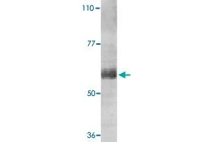 Western blot analysis of IL21R expression in human Raji cell lysate with IL21R polyclonal antibody  at 1 ug /mL . (IL21 Receptor Antikörper  (AA 20-32))