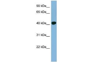 WB Suggested Anti-RING1 Antibody Titration: 0. (RING1 Antikörper  (Middle Region))