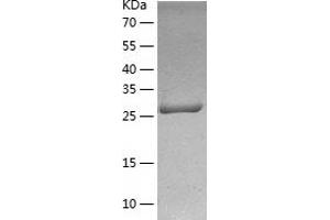Western Blotting (WB) image for CD46 (CD46) (AA 35-313) protein (His tag) (ABIN7122209) (CD46 Protein (CD46) (AA 35-313) (His tag))