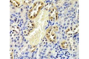 Immunohistochemistry of paraffin-embedded Mouse kidney using CDKN1B Polyclonal Antibody at dilution of 1:200 (40x lens). (CDKN1B Antikörper)
