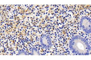 Detection of FAS in Human Appendix Tissue using Polyclonal Antibody to Factor Related Apoptosis (FAS) (FAS Antikörper)