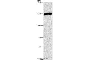 Western blot analysis of Raji cell, using UPF1 Polyclonal Antibody at dilution of 1:300 (RENT1/UPF1 Antikörper)
