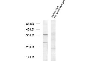 dilution: 1 : 1000, sample: cell lysate from Jurkat cells (PSMD8 Antikörper  (AA 4-232))