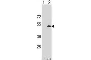 Western Blotting (WB) image for anti-Leupaxin (LPXN) antibody (ABIN2999719) (Leupaxin Antikörper)