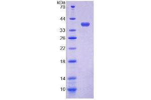 SDS-PAGE (SDS) image for Eosinophil Chemotactic Factor (ECF) (AA 24-100) protein (His tag,GST tag) (ABIN6236528) (ECF Protein (AA 24-100) (His tag,GST tag))