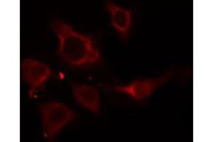 ABIN6274916 staining HepG2 cells by IF/ICC. (SLC27A5 Antikörper  (Internal Region))