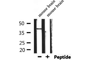 Western blot analysis of extracts from mouse brain, using TAS2R40 Antibody. (TAS2R40 Antikörper  (Internal Region))