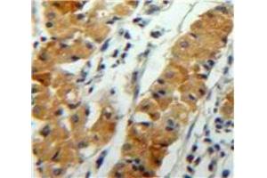 Used in DAB staining on fromalin fixed paraffin-embedded Stomach tissue (ANGPTL2 Antikörper  (AA 267-493))
