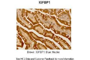 Immunohistochemistry (IHC) image for anti-Insulin-Like Growth Factor 2 mRNA Binding Protein 1 (IGF2BP1) (N-Term) antibody (ABIN2778994)