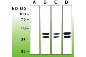 Western Blotting (WB) image for anti-Mitogen-Activated Protein Kinase 1/3 (MAPK1/3) (phosphospecific) antibody (ABIN870326) (ERK1/2 Antikörper  (phosphospecific))