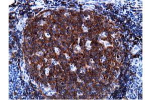 Immunohistochemical staining of paraffin-embedded Human Kidney tissue using anti-PIK3AP1 mouse monoclonal antibody. (PIK3AP1 Antikörper)