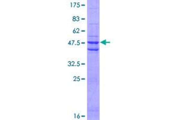 Dermatopontin Protein (DPT) (AA 1-201) (GST tag)