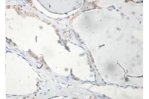 Immunohistochemical staining of formalin-fixed paraffin-embedded human thyroid showing membrane staining with FAM72A antibody at a dilution of 1/100. (FAM72A Antikörper  (AA 2-148))