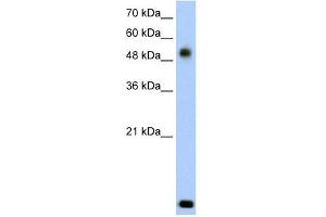 RSAD2 antibody used at 2. (RSAD2 Antikörper  (N-Term))